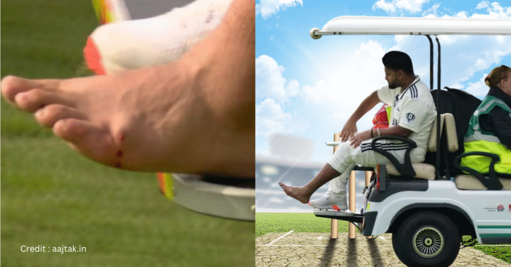 पंत की चोट